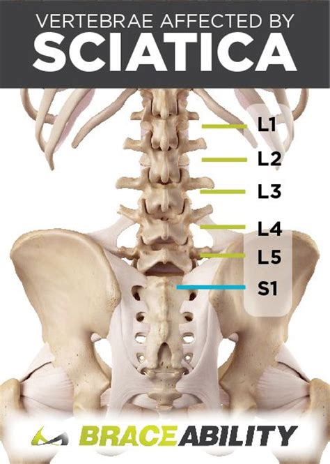 Pin on Back Injuries & Spine Disorders | What's Causing my Back Pain? Lower, Middle, & Upper ...