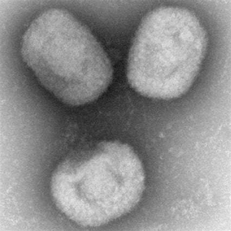 Controversial Paper Shows How to Make Pox Virus | RealClearScience