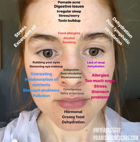 Can Face Mapping Really Help Improve Your Skin & Acne?