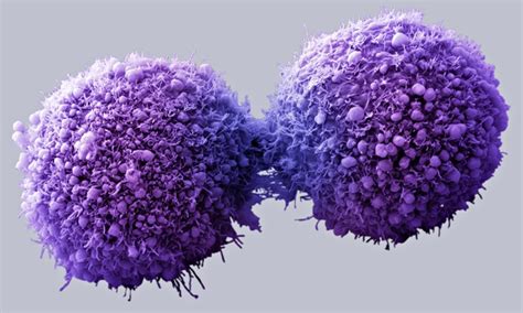 Buscan curar cáncer con nanopartículas de oro | Boletín BoCES
