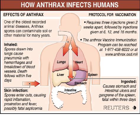 anthrax symptoms - pictures, photos