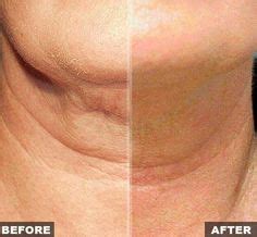 25 Sagging Neck Exercises ideas | neck exercises, sagging neck, facial exercises