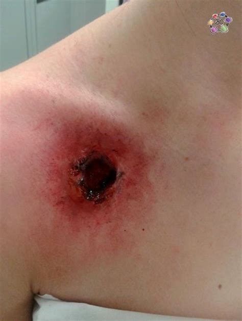 Bullet Wound by Sasha Corneil MUA | Special effects makeup, Wound makeup, Sfx makeup