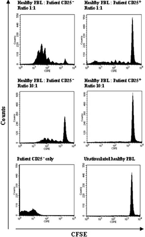 Patient CD25 ' lymphocytes suppress allogeneic activation ...