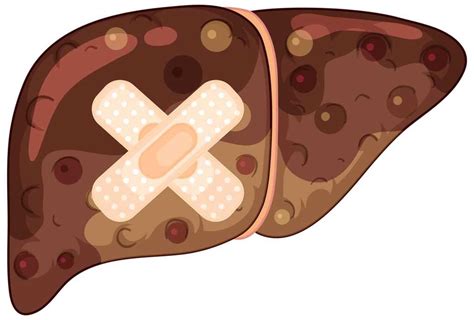 Do You Really Need to Do a Liver Cleanse? Here’s What Experts Really Think | Dr Farrah MD