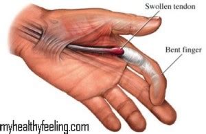 Finger Joint Pain Treatment, Causes