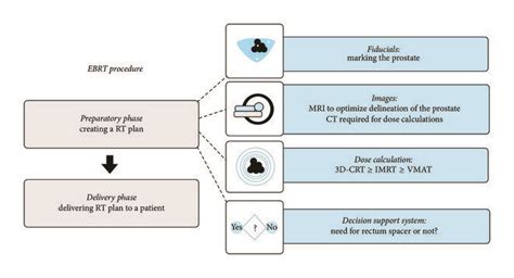 Overview of an EBRT procedure. | Download Scientific Diagram