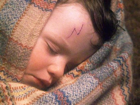 Harry Potter's scars | Harry Potter Wiki | Fandom