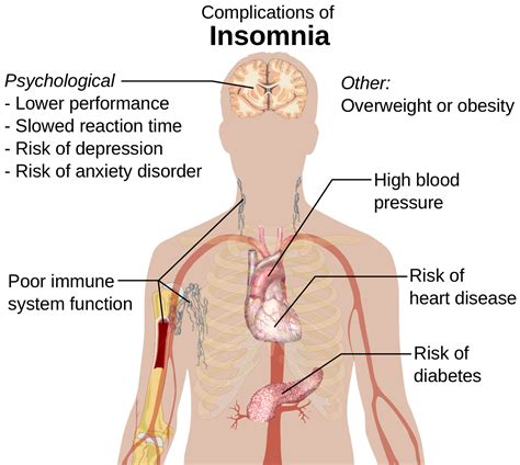 Insomnia Treatment in Nadipathy