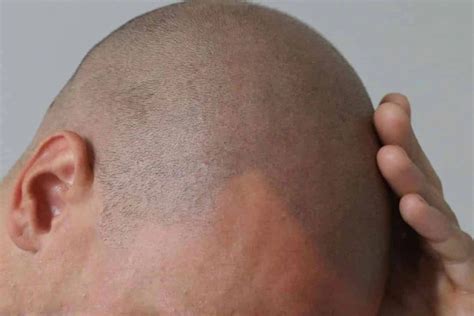 A Guide to Hairline Tattoos | Man of Many | Hairline tattoos, Hair ...