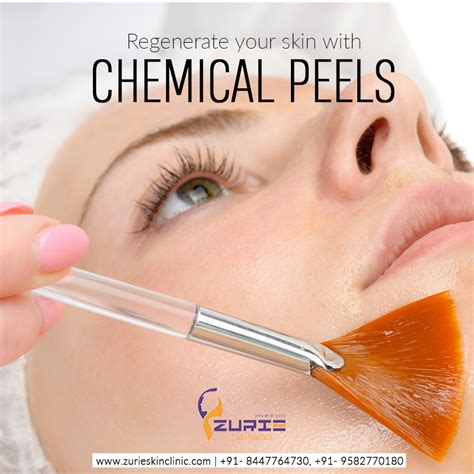 Chemical Peel is a popular and effective aesthetic procedure that can enhance general appearance ...