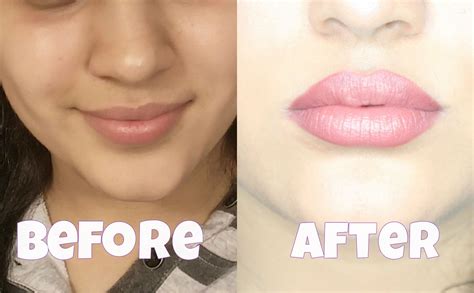 How To Get Bigger Lips Exercises – Online degrees