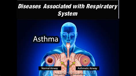 Respiratory system -Diseases Associated with respiratory system - YouTube