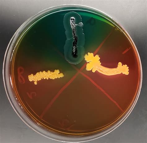 Hektoen Enteric Agar Diagram | Quizlet