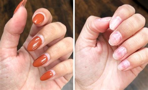 The DIY Guide to Removing Gel, Dip and Acrylic Nails—Without Damage | Beautylish