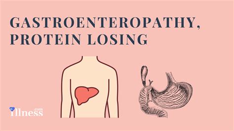 Gastroenteropathy, Protein Losing : Overview, Causes, Symptoms ...