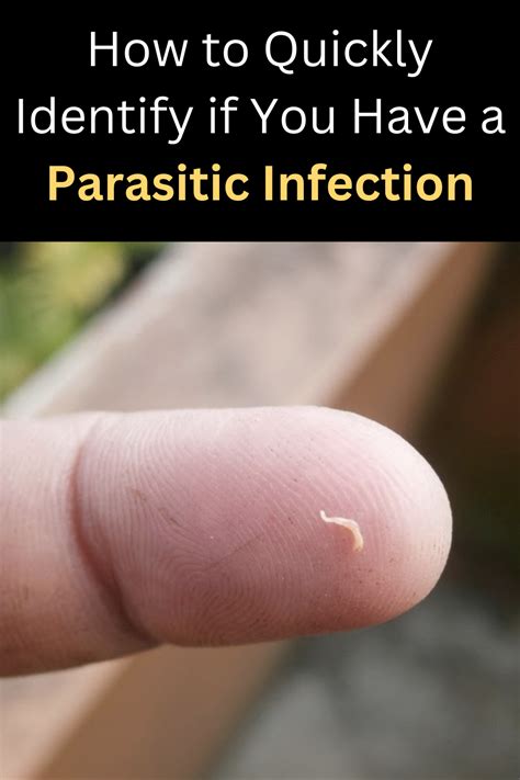 Main Symptoms of a Parasitic Infection | Health facts, Health and fitness articles, Health info