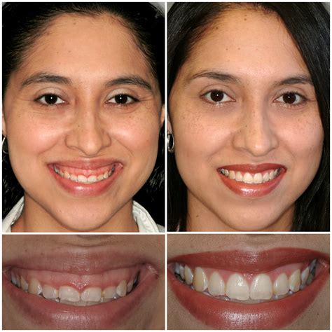 Smile Stories in San Antonio, TX | Stone Oak Aesthetic Dentistry