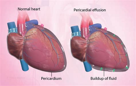 Health Condition : Symptoms, Causes, Treatment and More