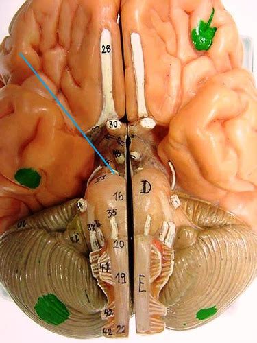 Cranial Nerve: Motor Flashcards | Quizlet