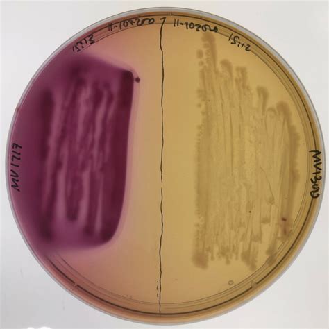 The two utilised E. coli strains growing on differential MacConkey ...