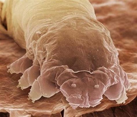 What Is The Microscopic Mite That Lives On The Human Skin Called ...