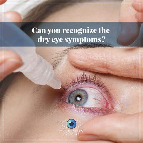 Dry Eye Syndrome - Precision Eye - Cataract and Laser Eye Surgery - Optometrist - Baltimore