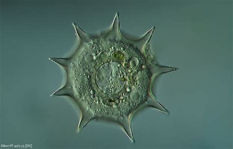 Arcella dentata /Amoebozoa | protists | Pinterest