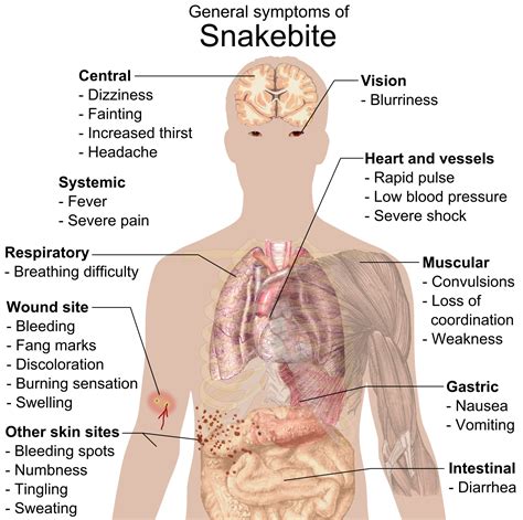File:Snake bite symptoms.png