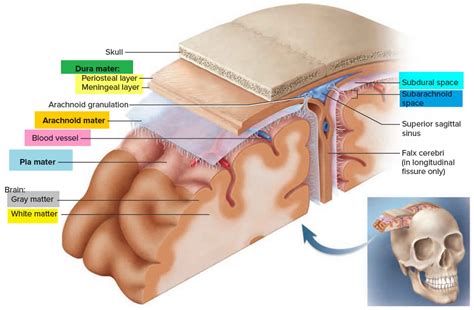 Epidural hematoma causes, signs, symptoms, diagnosis & treatment