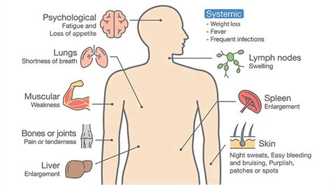 What Are Some of the Common Symptoms of Leukemia? | Everyday Health