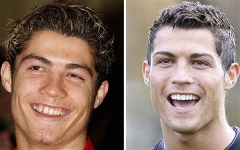 Cristiano Ronaldo’s Before and After Plastic Surgery Photos are ...