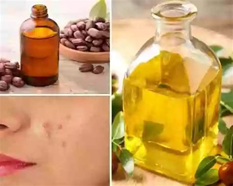 Jojoba Oil for Acne - How to Use for Skin | AOS Products