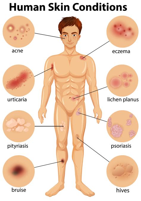 Various human skin conditions 300491 Vector Art at Vecteezy