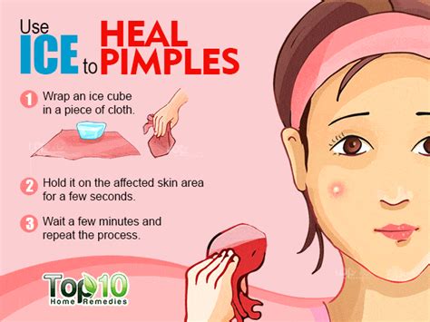 How to Get Rid of Pimples Fast | Top 10 Home Remedies | How to remove pimples, How to get rid of ...