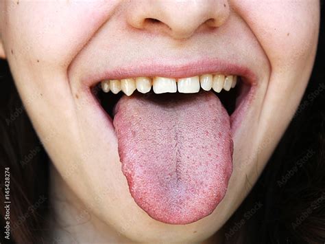 Attractive girl showing a healthy tongue Stock Photo | Adobe Stock