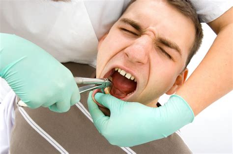 Does tooth extraction hurt: What to expect after the extraction ...