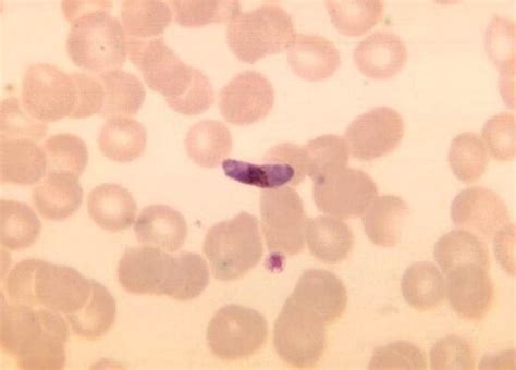 Free picture: plasmodium falciparum, rings, delicate, cytoplasm, small, chromatin, dots