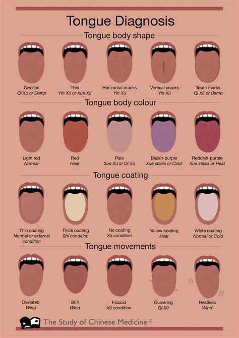Chinese Tongue Diagnosis Chart