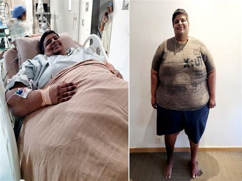 Bariatric Surgery Helps Man Weighing 262 Kgs Lose 41 Kg In One Month ...