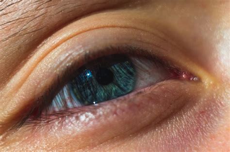 Types of Eye Injuries: What You Need to Know - MyHealthTales