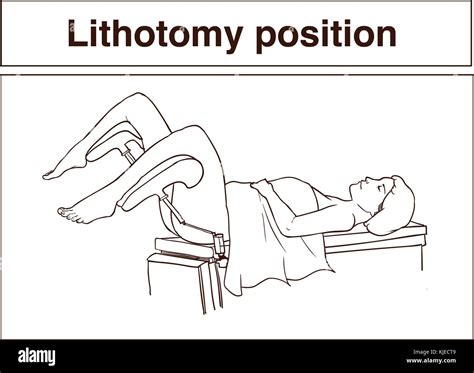 Lithotomy position hi-res stock photography and images - Alamy