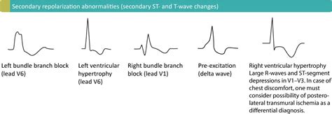 心電圖判讀 Electrocardiography interpretation