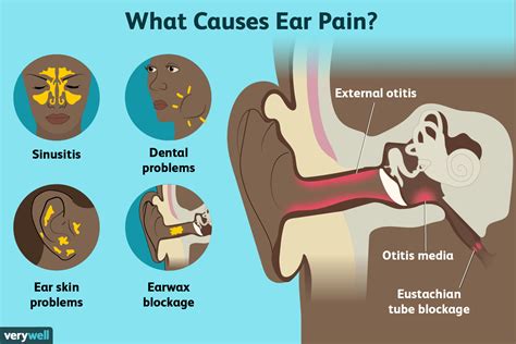 Douleurs de l'oreille : causes, traitement et quand consulter un médecin