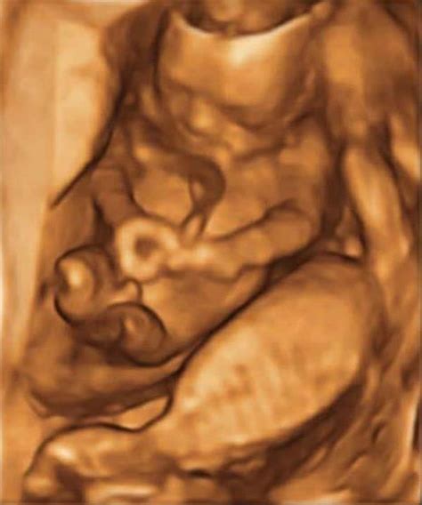 16 Weeks Pregnant With Twins: Symptoms, Belly & Ultrasound Pictures – About Twins