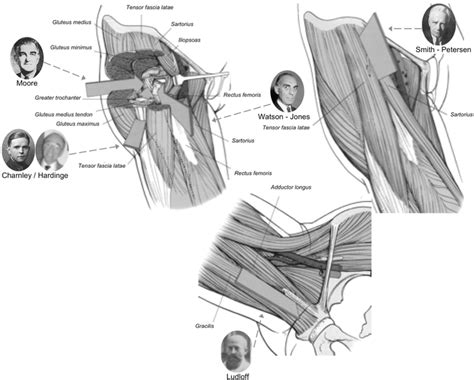 Overview of eponyms discussed [8] | Download Scientific Diagram