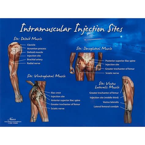 Life/form Intramuscular Injection Sites Chart