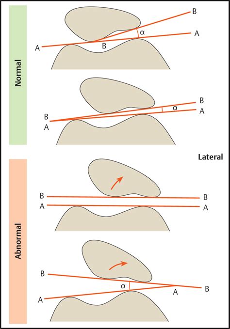 Knee | Radiology Key