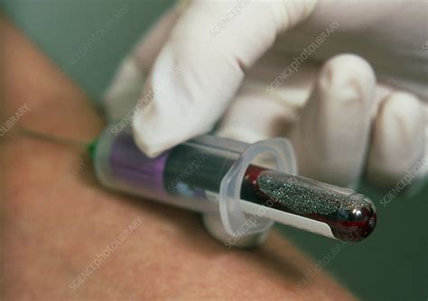 Blood sampling - Stock Image - M532/0551 - Science Photo Library