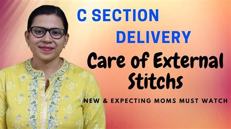 External Stitches Care after C-Section - सिजेरीयन डिलीवरी के बाद external stitches care कैसे ...